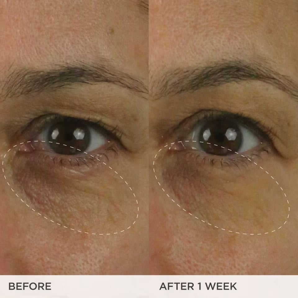 Bright-Eye-Cream-FS-05-Clinicals.jpg