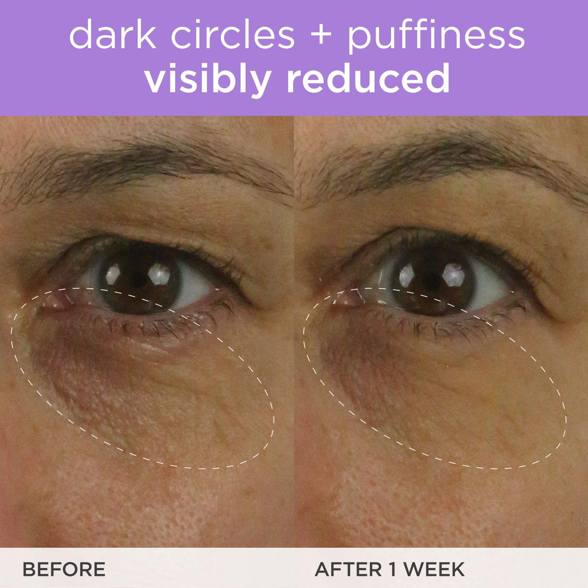 The Brightening Eye Cream